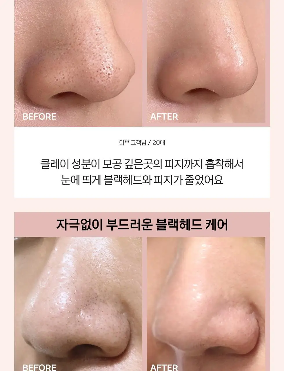 [머랭솝/팩브러쉬증정] 스킨시그널 클레이 효소클렌저 70g 팩브러쉬 증정기획 (핑크/그린) 상세페이지 25